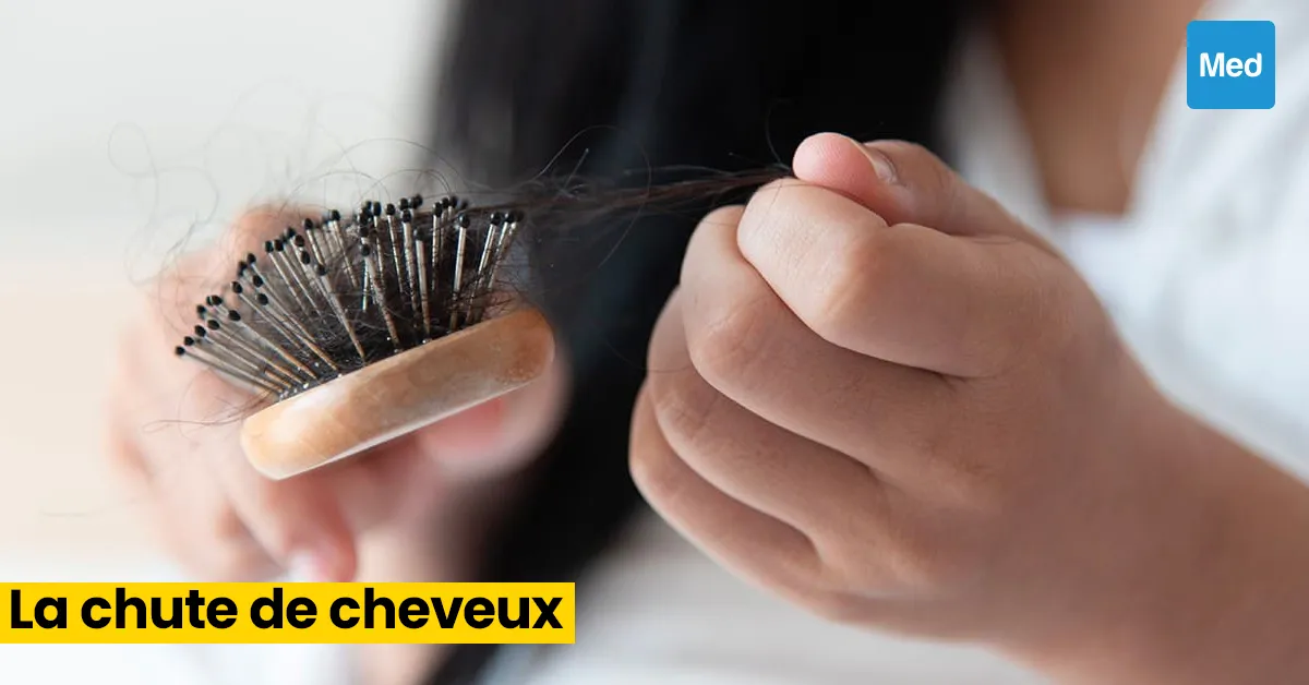 Chute de cheveux : causes, traitements et prévention